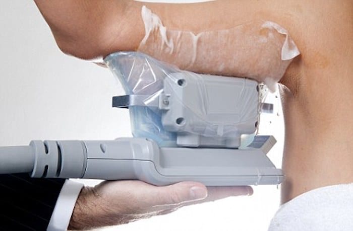 fat freezing arms Dunstable