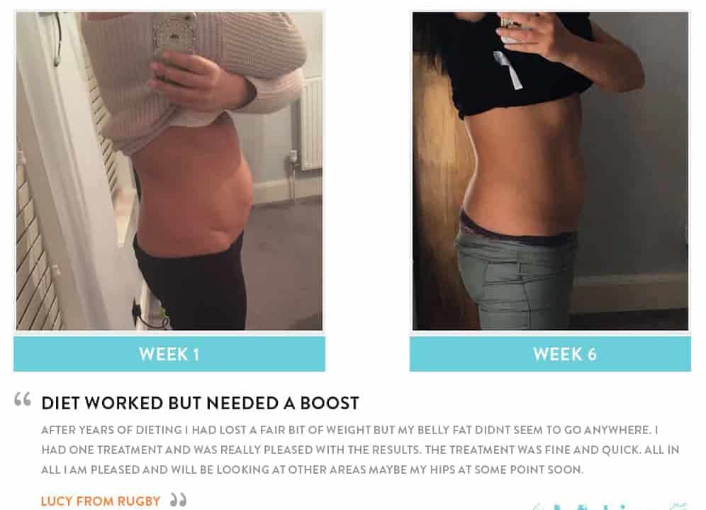 Before and After Dieting Dunstable