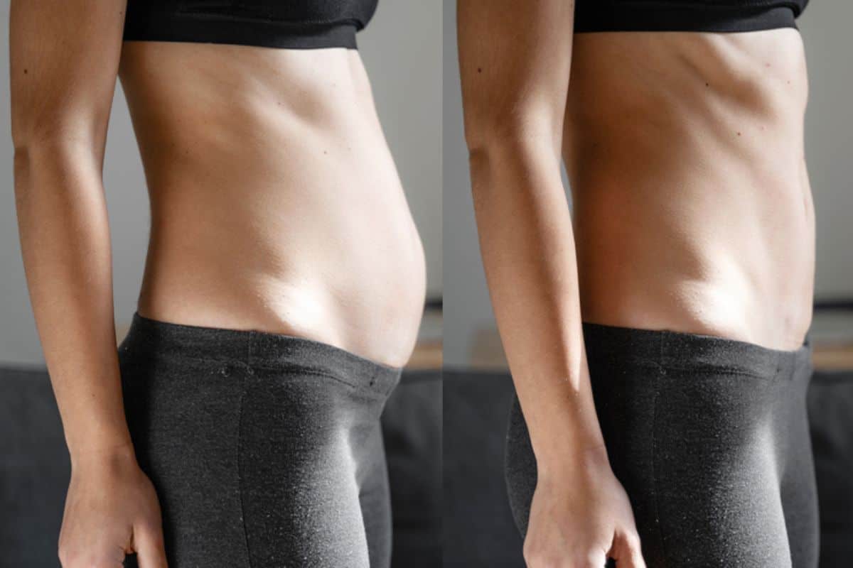 Post-Pregnancy: What Happens to Your Abdominal Muscles After Birth Dunstable