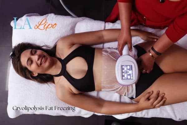 woman getting cryolipolysis Dunstable