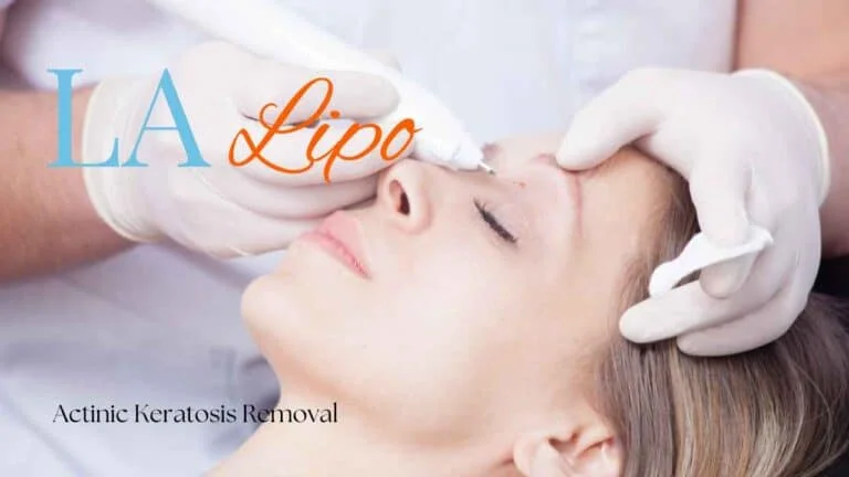 Woman receiving Actinic Keratosis Removal Treatment Dunstable