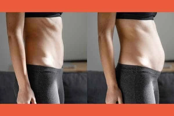 LA-EMS Body Sculpting results Dunstable