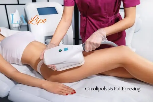 Woman receiving coolsculpting Dunstable treatment on her thighs