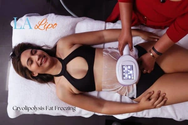 woman getting cryolipolysis Dunstable