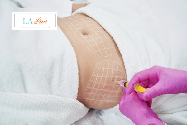 aqualyx fat dissolving injections Dunstable