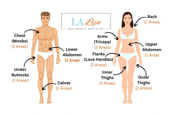 LA LIPO Cryolipolysis Areas Dunstable