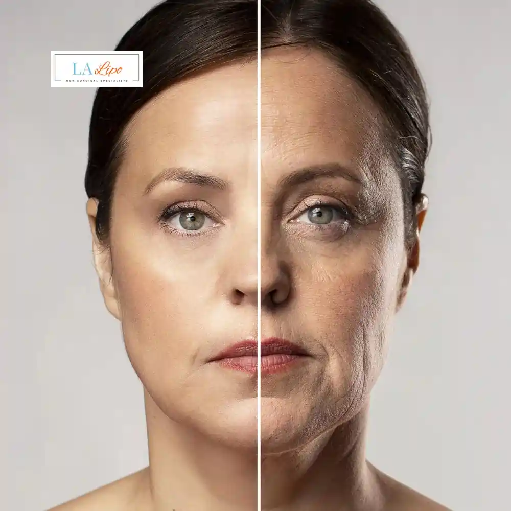 How Can You Tell If Non-Surgical Skin Tightening Is Right for You Dunstable?