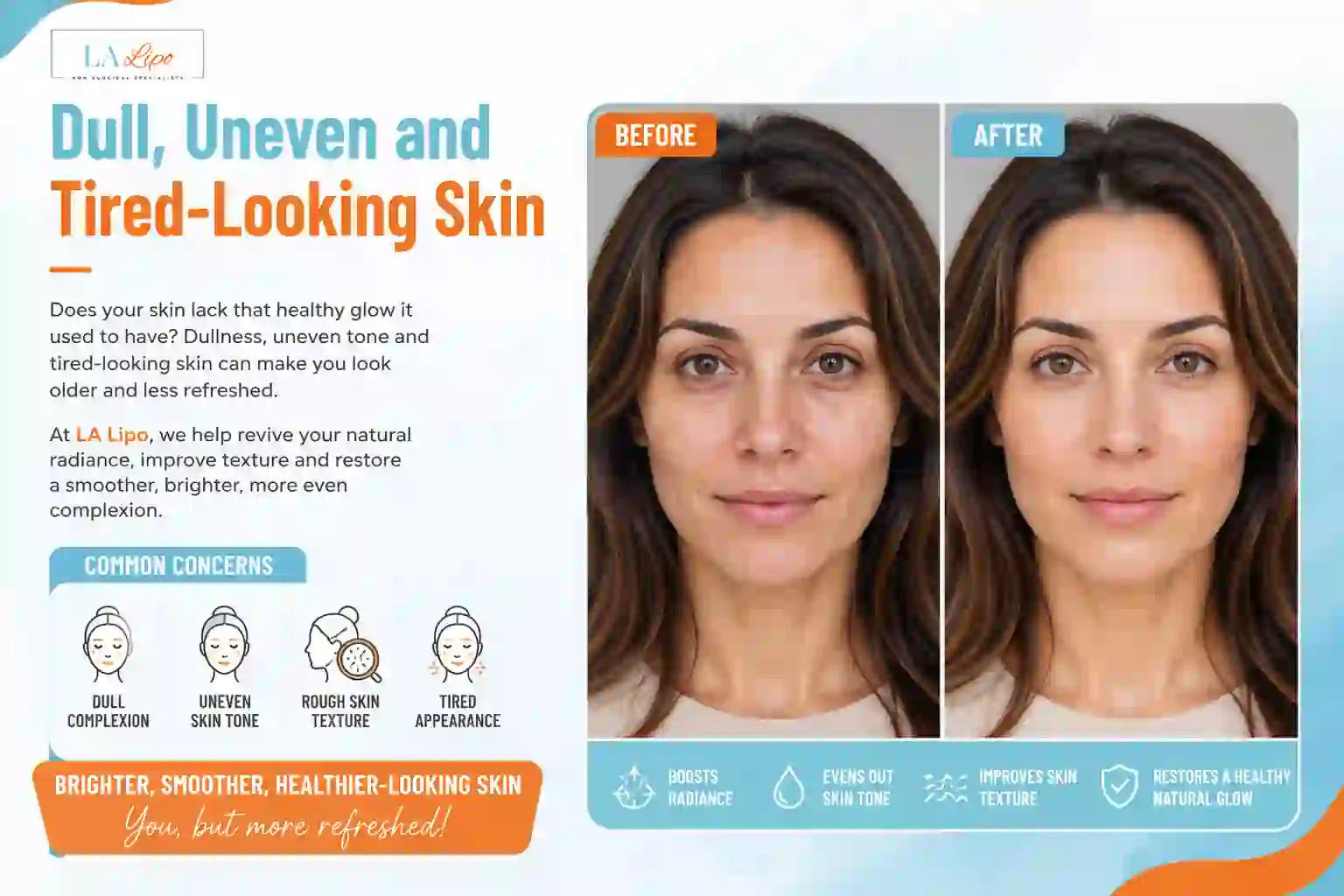 Sign #5: Dull, Uneven and Tired-Looking Skin Dunstable