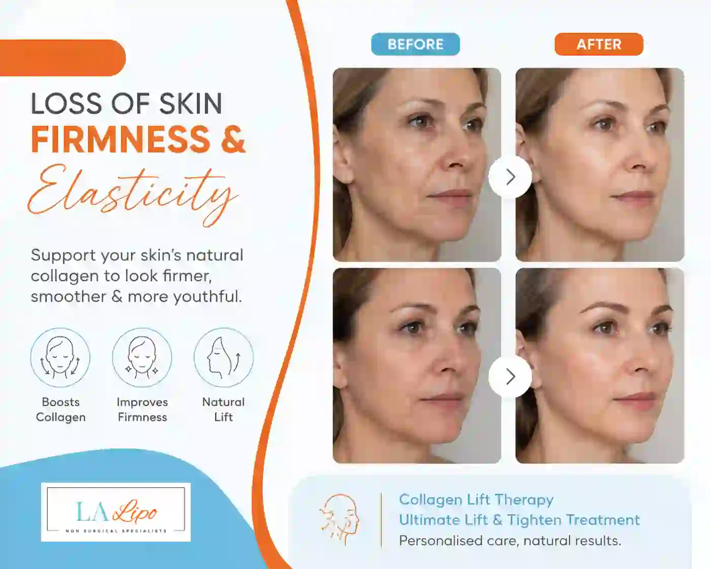 Sign #7: Loss of Skin Firmness and Elasticity Dunstable